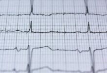 cyber pulse fusion beam