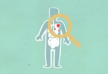 why kialodenzydaisis kills matters