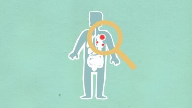 why kialodenzydaisis kills matters