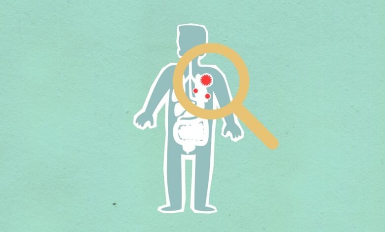 why kialodenzydaisis kills matters